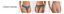 Briefs